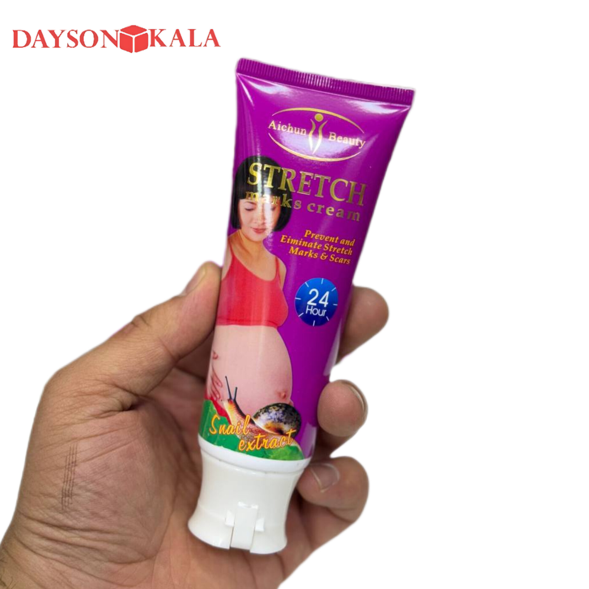 کرم رفع ترک شکم آیچون بیوتی Aichun Beauty | ضد ترک پوستی و درمان استرچ مارک