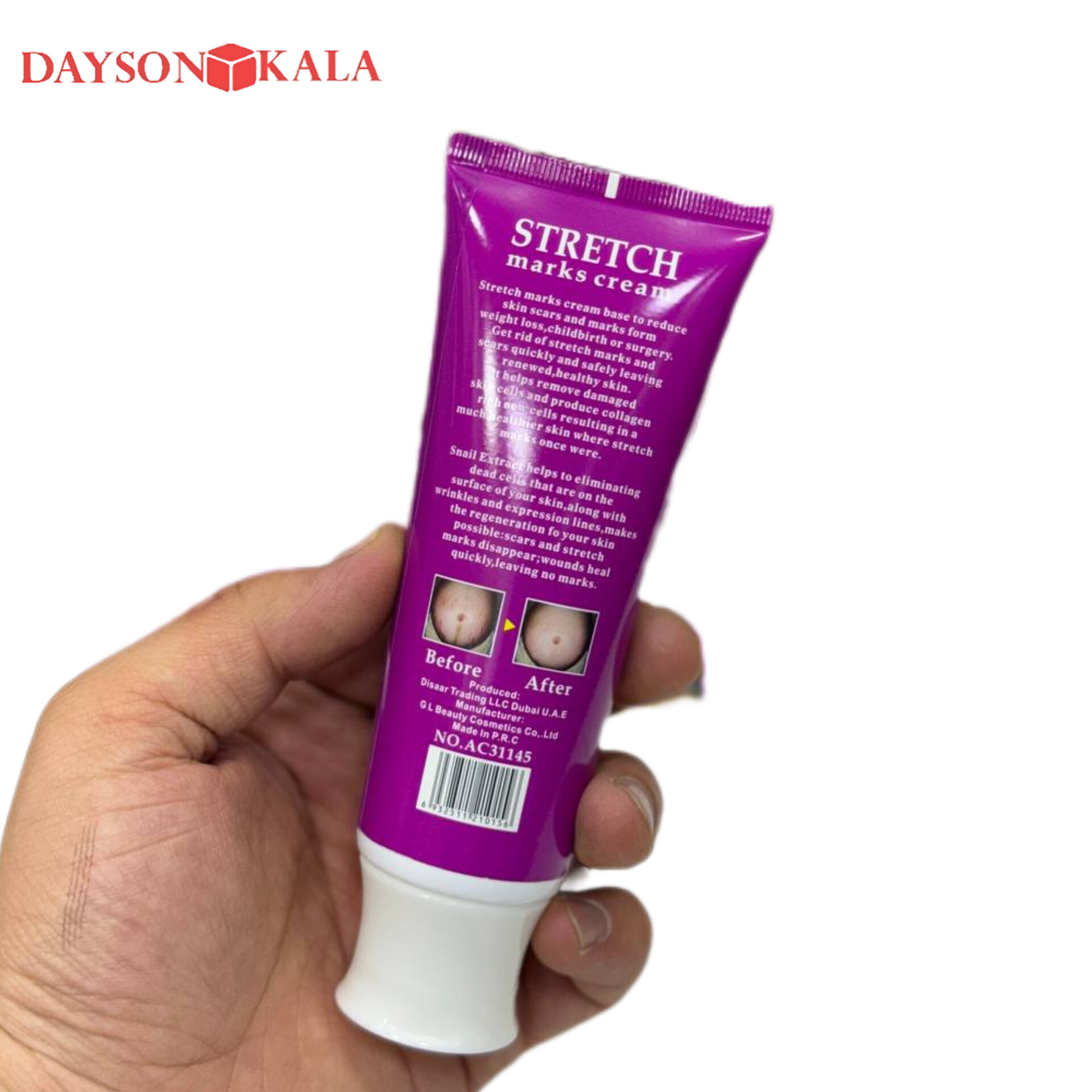 کرم رفع ترک شکم آیچون بیوتی Aichun Beauty | ضد ترک پوستی و درمان استرچ مارک